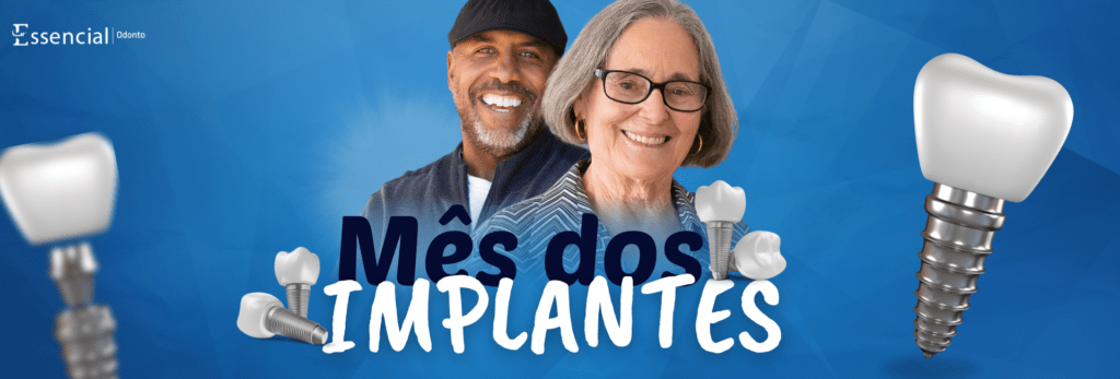 Implantes dentários, essencial odonto, implantes baratos, implante acessivel, especialista em implante
